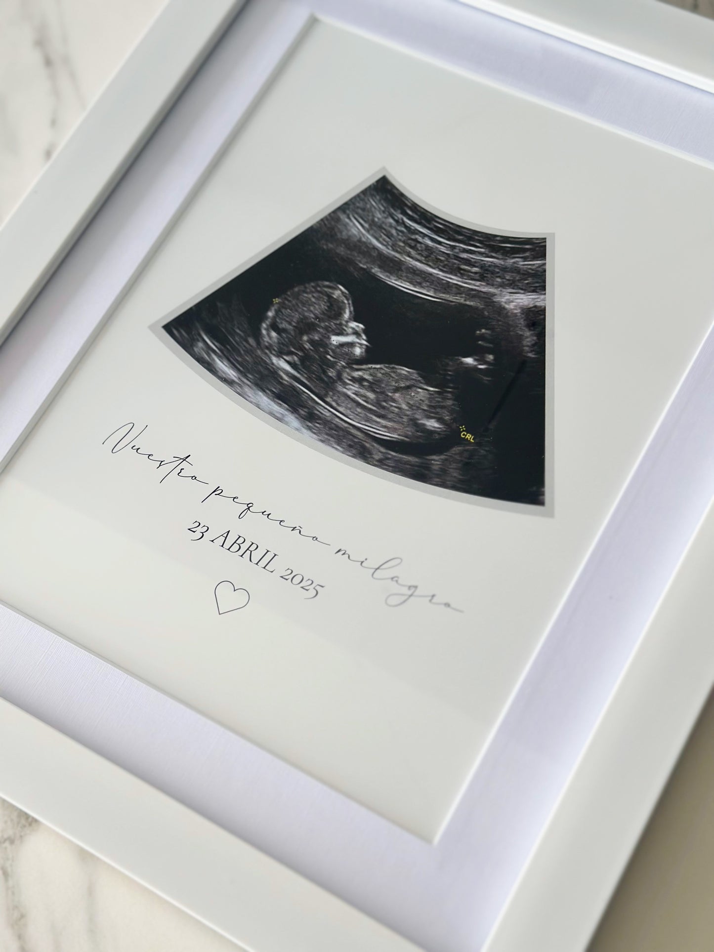 Cuadro Ecografía Minimalista