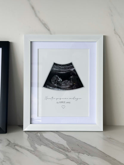 Cuadro Ecografía Minimalista