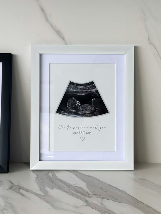 Cuadro Ecografía Minimalista